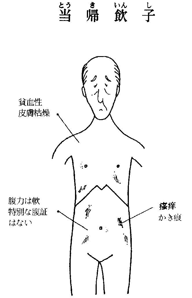 当帰飲子