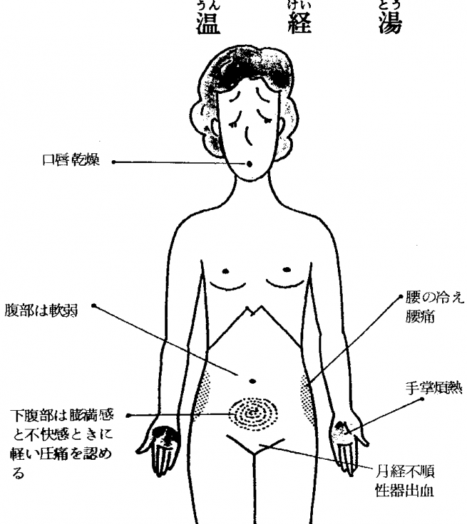 温経湯