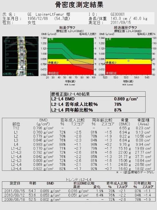 骨密度測定結果1