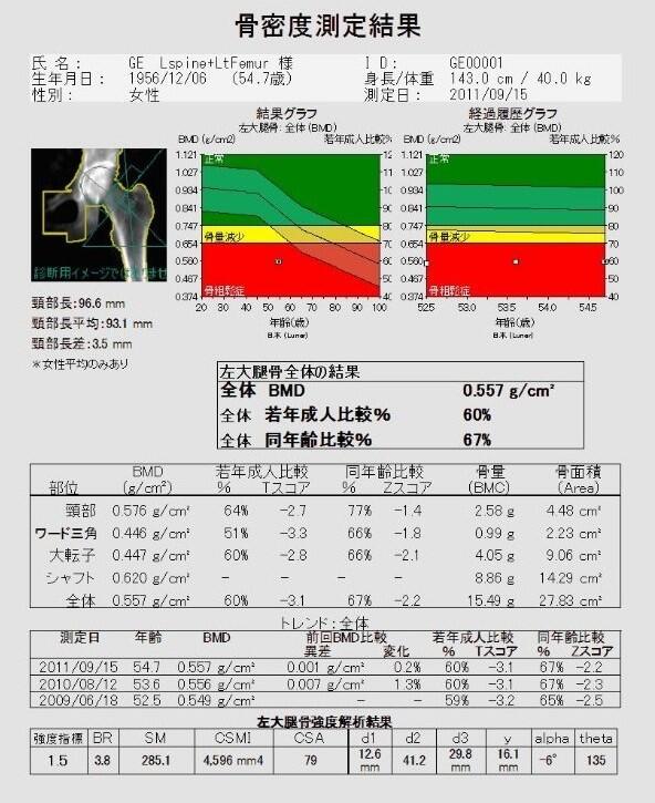 骨密度測定結果2